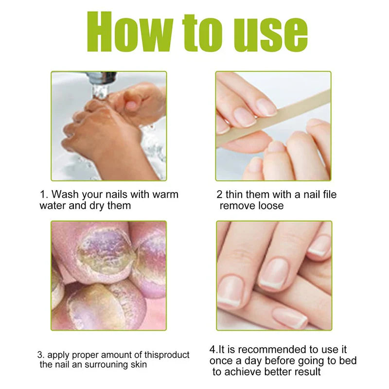 EELHOE – Nail Treatment Repair Gel My Store 2